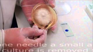 Microbiology: Lactophenol Cotton Blue Technique