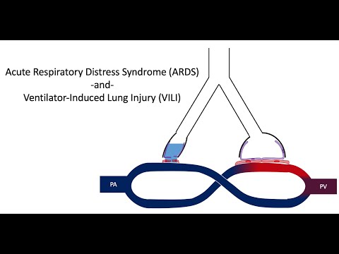 ვიდეო: მწვავე რესპირატორული დისტრეს სინდრომი (ARDS) კატებში