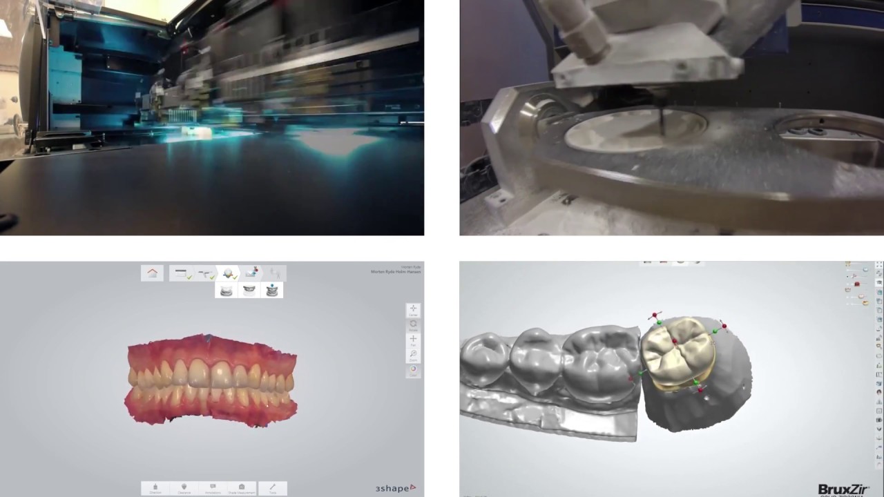 What is the Dental Laboratory Profession? YouTube