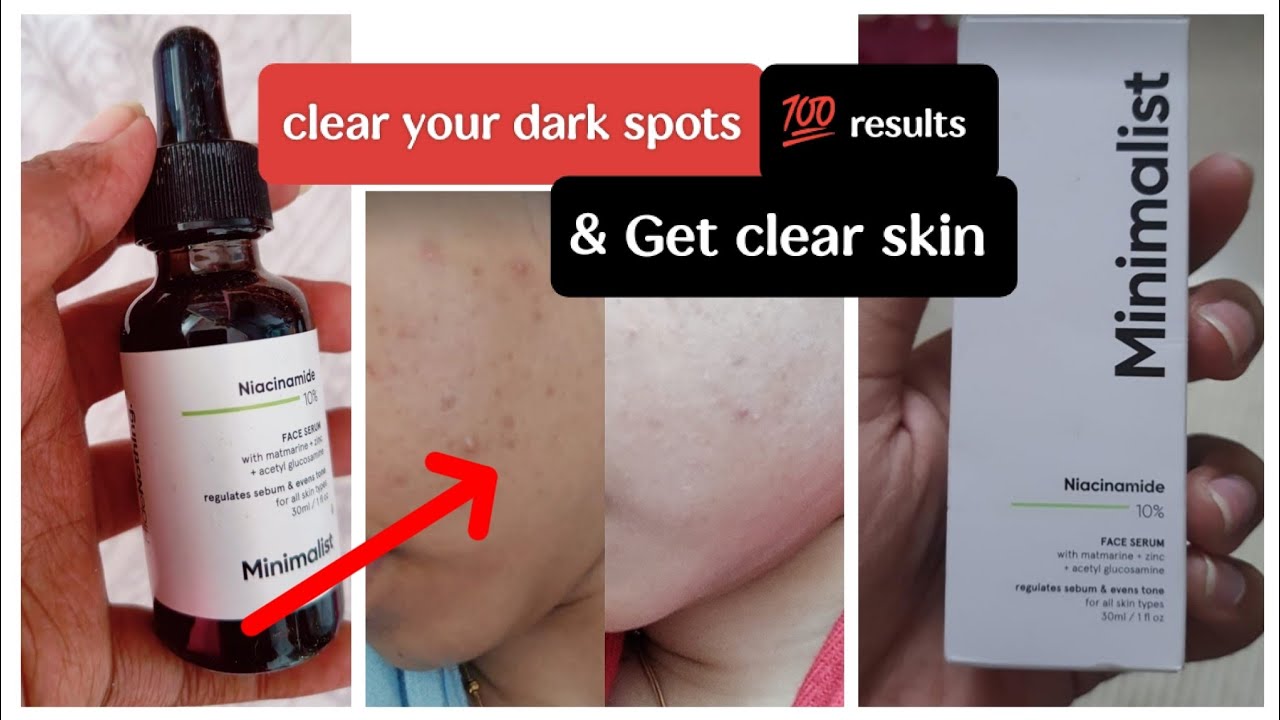 minimalist-niacinamide-serum-review-in-tamil-niacinamideserum-youtube