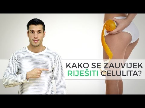 Video: Kako sakriti keloidne ožiljke šminkom: 14 koraka (sa slikama)