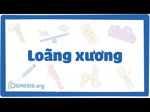 Video: Cách chẩn đoán loãng xương: 12 bước (có hình ảnh)