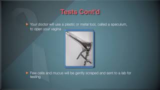Cervical Cancer Prevention Part 2