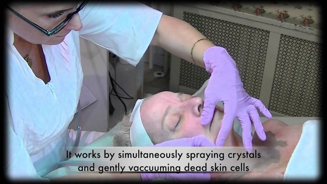 Beautiful You by Christine - Microdermabrasion