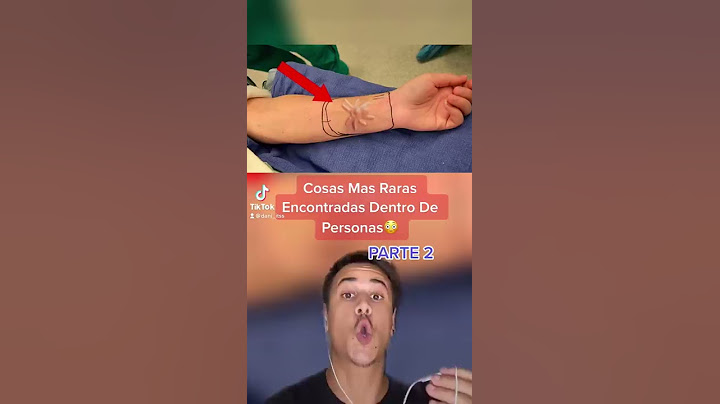 Cosas Mas Raras Encontradas Dentro De Personas 😳Parte 2 #shorts