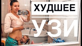 ЗАЧЕМ ВАМ ПОЛ РЕБЕНКА?!! // Худшее узи в моей жизни