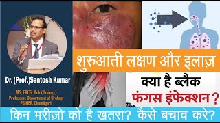 Black Fungus| black fungus kya hai| black fungus after covid|Dr.(Prof)Santosh Kumar PGI