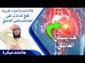 علامات وأشياء غريبة تقع لك تدل على إصابتك بالمس العاشق 