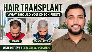 Hair Transplant in Chennai (HX-IISY) | Best Results & Cost of Hair Transplant in Chennai