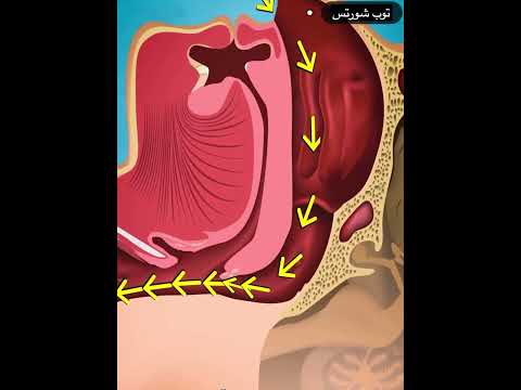 اسباب الشخير اثناء النوم