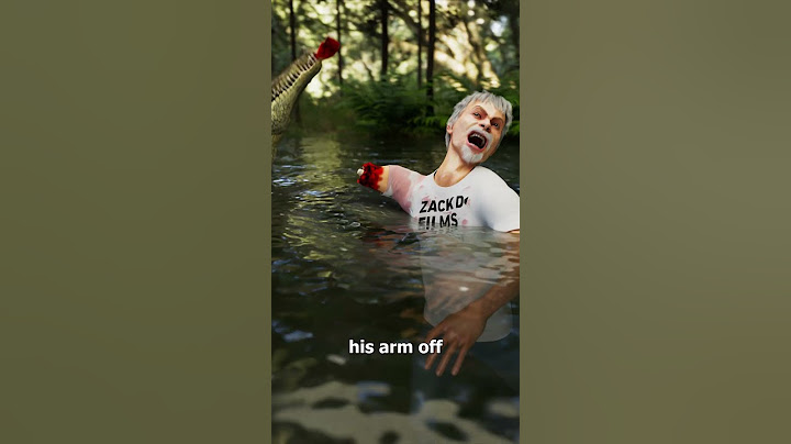 He Survived An Alligator Attack 😨