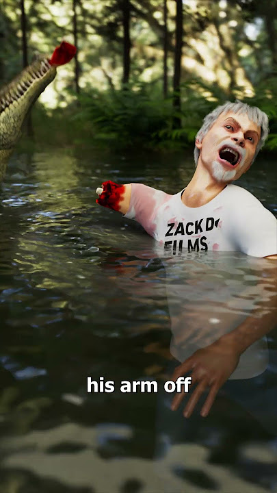 He Survived An Alligator Attack 😨