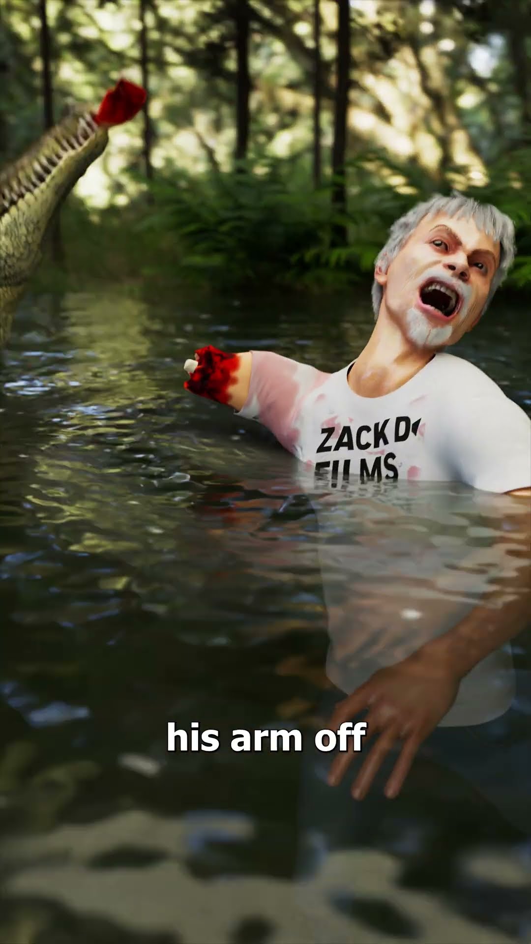 He Survived An Alligator Attack ?