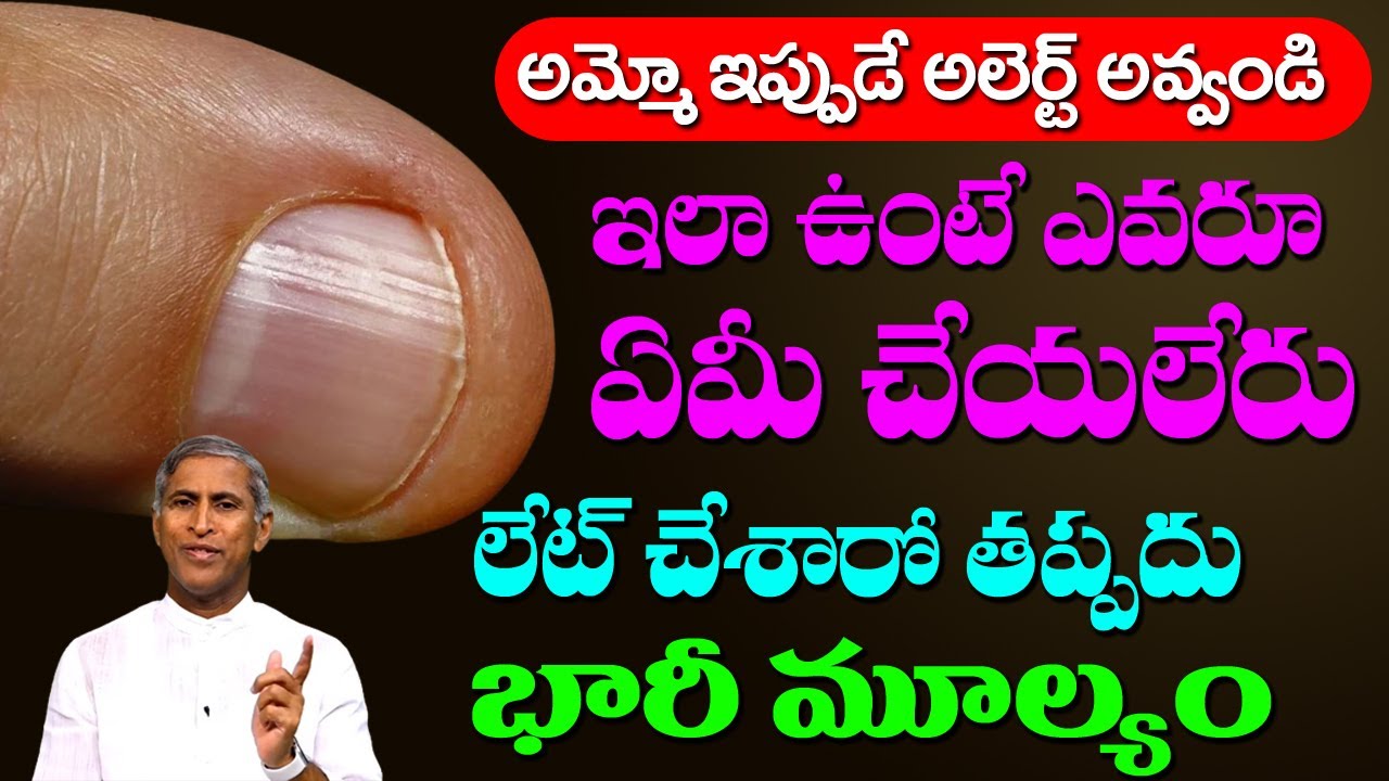 Nail 🥵🥵 అమ్మో ఇప్పుడే చెక్ చేసుకోండి ఇలా ఉంటే నేను కూడా ఏమి చేయలేను | Dr Manthena Satyanarayana Raju