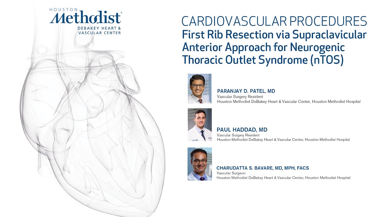 First Rib Resection via Supraclavicular Anterior Approach for nTOS ...