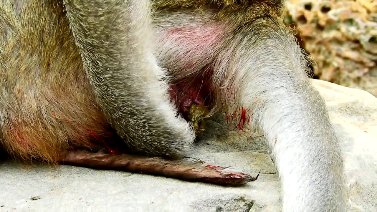 foundation medicine BreakHeart to see Newborn mom get strange condition on the back