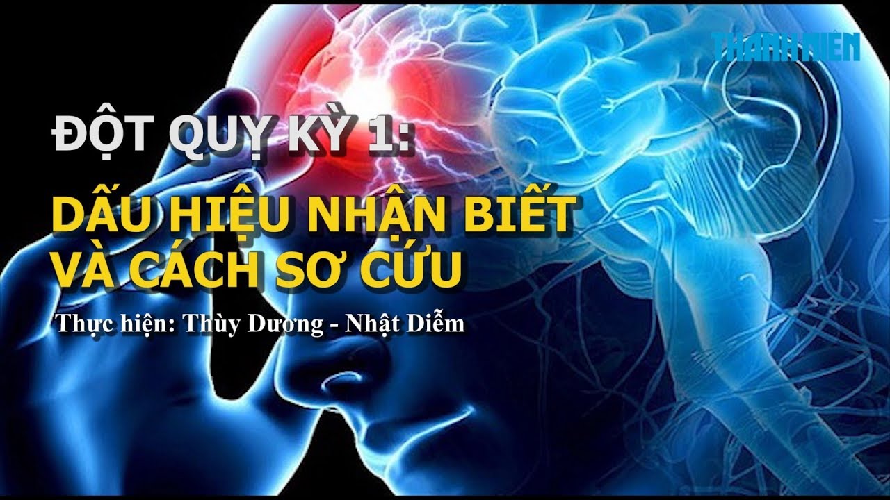 Đột quỵ: Dấu hiệu nhận biết và cách sơ cứu