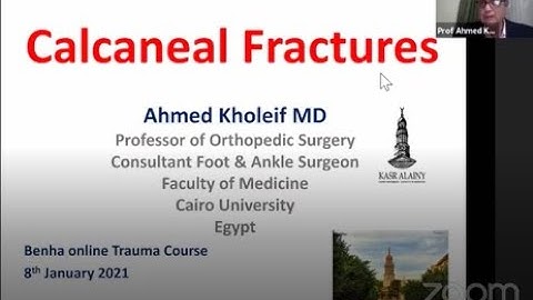 Calcaneal Fractures (Prof. Ahmed Kholeif )