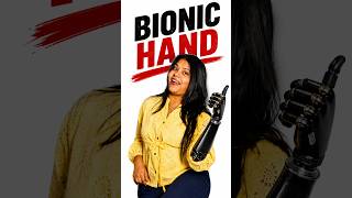 This Bionic Hand Will BLOW Your Mind 🦾⚡