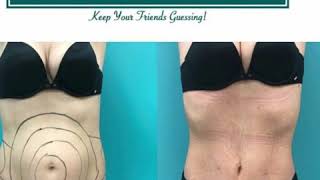 Smart Lipo - Medical Spa -  Brick, New Jersey – 732-262-5476