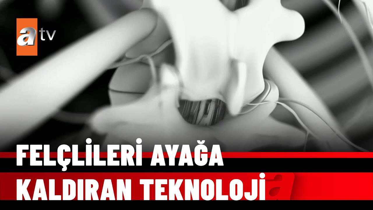 Omurga implantı - atv Haber 11 Şubat 2022