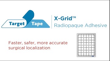 X-Grid | Informational Video