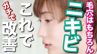 【毛穴&ニキビ】悩んでる人こそ絶対に見て。