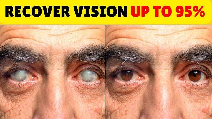 Make Your Eyesight Better Up To 95% Do This Every Day And Your Vision Will Be Restored