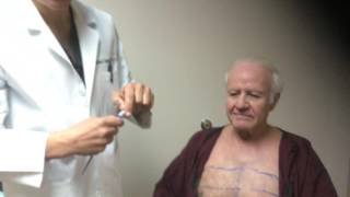Body Hair Transplant (BHT) - Chest Hairs to Scalp | Dr. Jeffrey Epstein Chest Hair Transplant Before And After