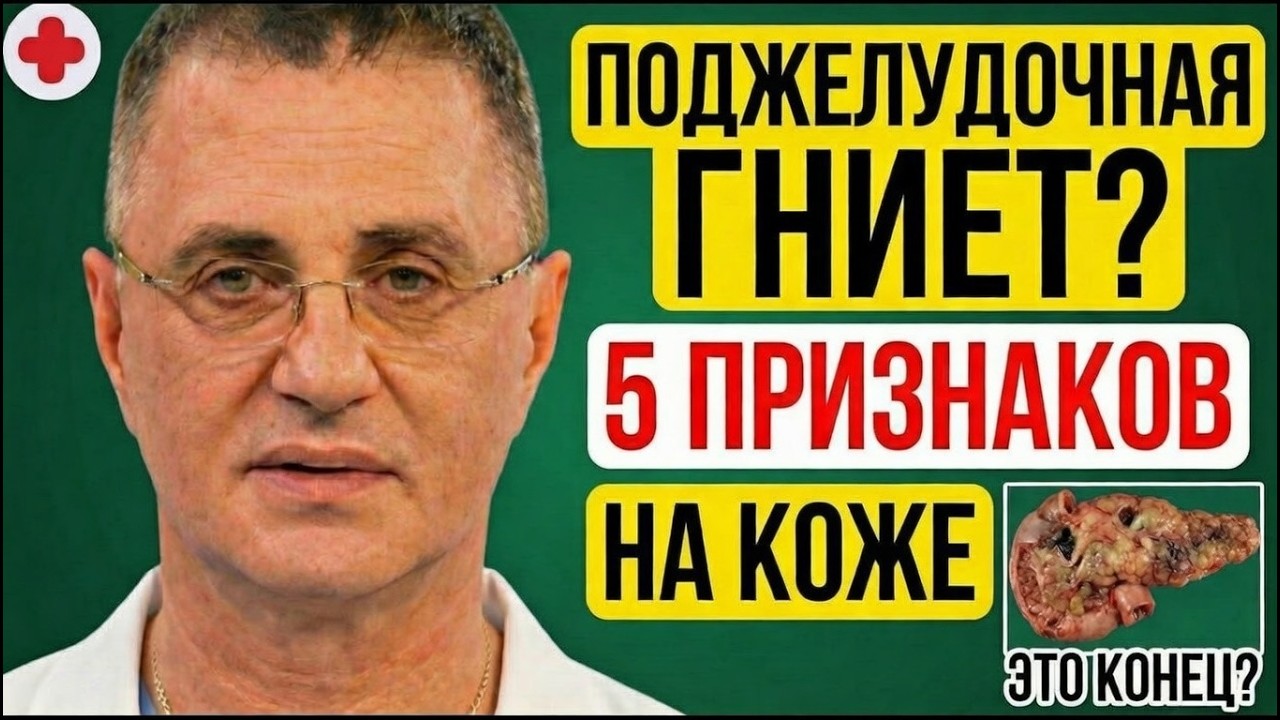 Пятна На Коже - Конец Поджелудочной? КАК ПРОВЕРИТЬ ТЕЛО? Доктор Мясников