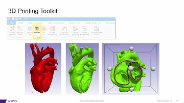 Simpleware Software for Point-of-Care 3D Printing | Medical Imaging to 3D Models