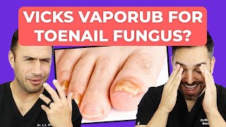 Ointment To CURE Toenail Fungus | Doctorly Investigates