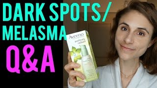 melasma cream hydroquinone