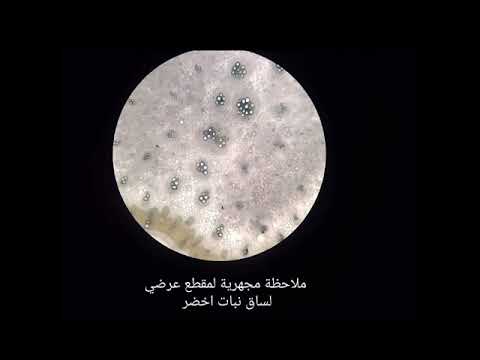 عمل تطبيقي الدعامة النسيجية المسؤولة عن نقل النسغ الخام الناقص