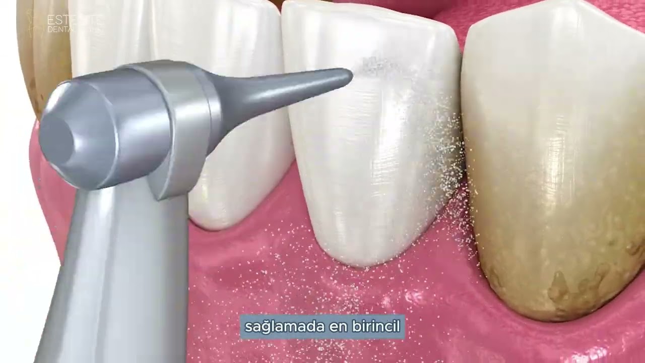Estelite Dental Clinic kliniğimiz videosu