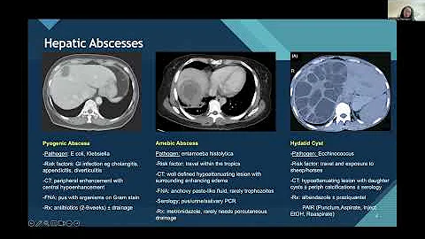 SSAT Resident & Fellows Education Committee Webinar: High-Yield Topics for the ABSITE 2026: Part II