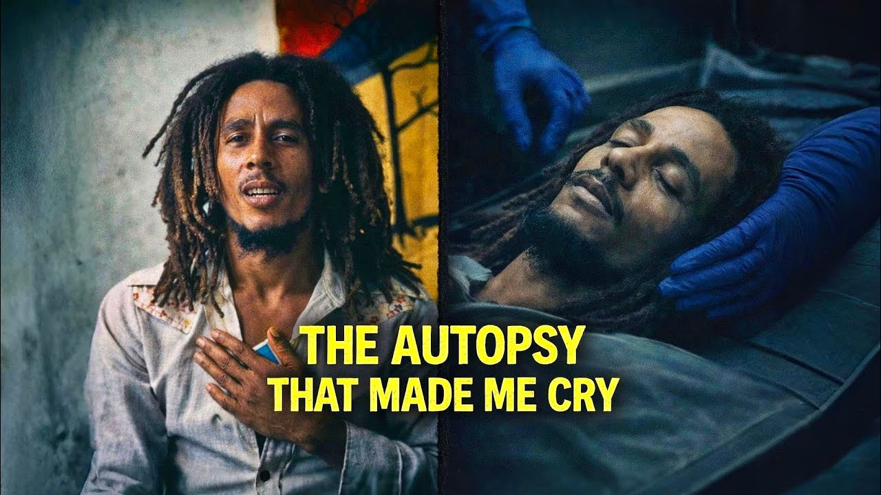 The Autopsy of Bob Marley — The Diagnosis That Was Ignored Until It Was Too Late