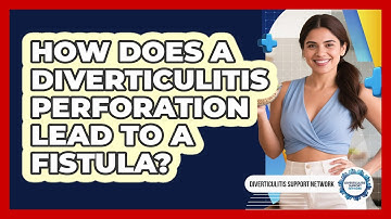 How Does A Diverticulitis Perforation Lead To A Fistula? - Diverticulitis Support Network