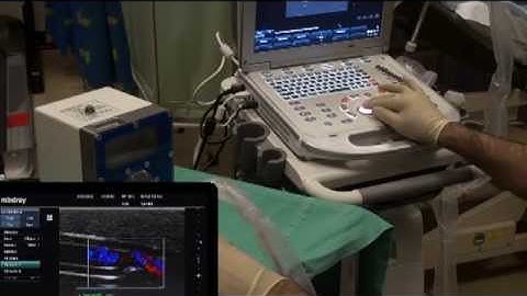 Axiom Pulsatile Flow Simulator: Teaching arterial stenosis detection