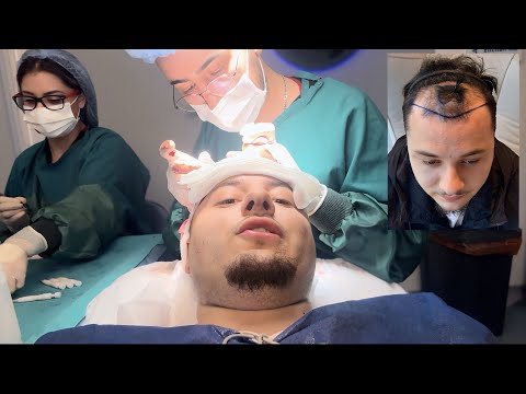 I Had A Life Changing Surgery !