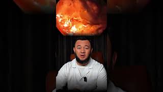 Anemiyani to'g'ri davolash!