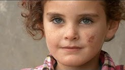 زندگی رقت بار پناهجویان سوری در لبنان و اردن