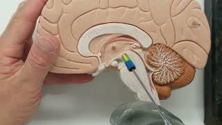 Ventricle cerebrospinal fluid model