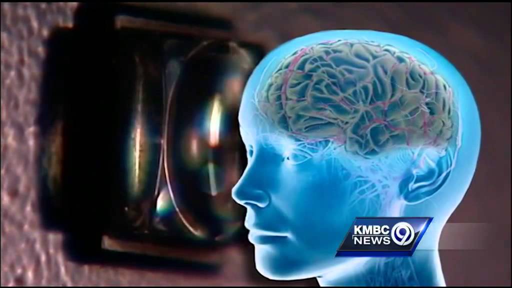 Can vision training help prevent concussions in athletes?