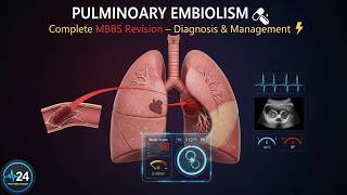Pulmonary Embolism Explained | Diagnosis, Wells Score, Management & Clinical Case | MBBS Revision