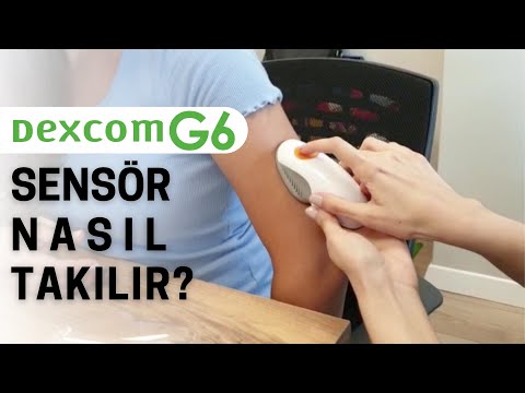 Dexcom G6 Sensör Nasıl Takılır? - Dexcom G6 Sensör Yerleştirme Videosu