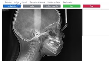WebCeph: A.I.(artificial intelligence) Cephalometric Analysis platform for Orthodontic Diagnosis