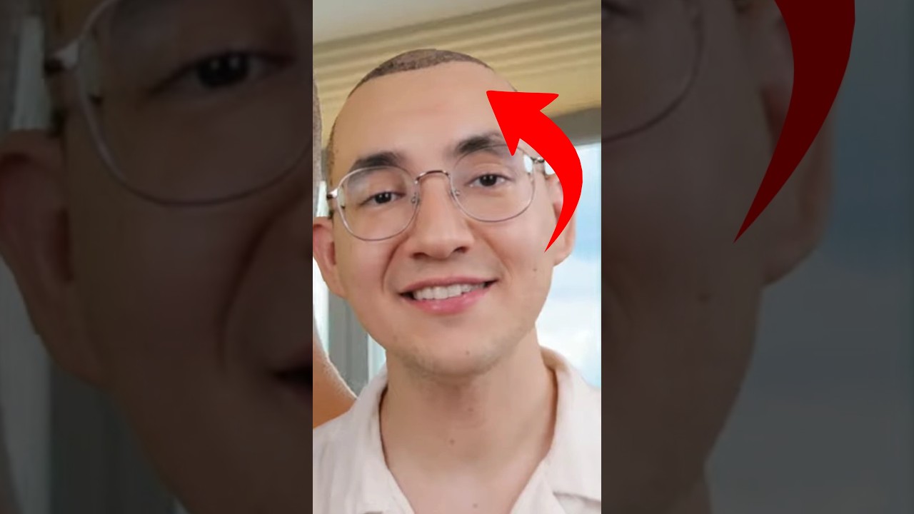 escolheram logo ESSA foto pro DEARO