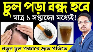 চুল পড়া বন্ধ করে  নতুন চুল গজানোর উপায় | চুল পড়ার ঘরোয়া সমাধান | How To Stop Hair Fall |