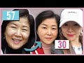 My mom got a new face with thread lift in Korea│Seoul Guide Medical